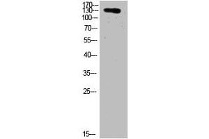 Western Blot analysis of HELA cells using primary antibody diluted at 1:2000(4 °C overnight). (COL19A1 anticorps  (AA 161-210))