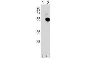 Western blot analysis of IRF4 antibody and 293 cell lysate (2 ug/lane) either nontransfected (Lane 1) or transiently transfected (2) with the IRF4 gene. (IRF4 anticorps  (AA 164-191))