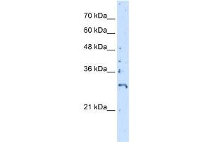 WB Suggested Anti-CREBZF Antibody Titration:  5. (CREBZF anticorps  (C-Term))