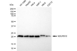 Western blotting analysis using NDUFB10 antibody (ABIN7799546).