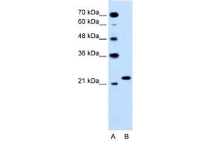 WB Suggested Anti-RAB14  Antibody Titration: 0. (RAB14 anticorps  (C-Term))