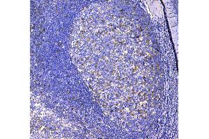 IHC analysis of CD11c using anti-CD11c antibody .