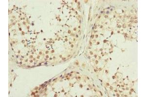 anti-KIAA0391 (KIAA0391) (AA 314-583), (Catalytic Subunit) antibody