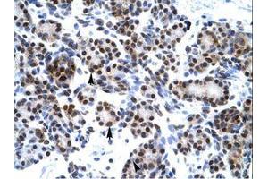 Image no. 3 for anti-Hairy and Enhancer of Split 7 (HES7) (AA 63-112) antibody (ABIN6735843)