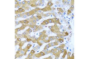 Immunohistochemistry of paraffin-embedded human liver using IFIT3 antibody (ABIN1680389, ABIN3018293, ABIN3018295 and ABIN6220427) at dilution of 1:100 (40x lens). (IFIT3 anticorps  (AA 128-331))