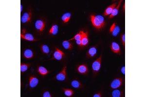 IF analysis of Alpha Internexin using anti-Alpha Internexin antibody (ABIN4886634).