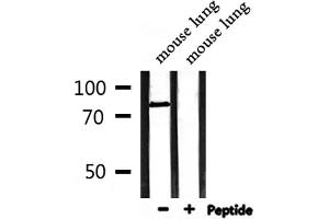 Western blot analysis of extracts from mouse lung, using MLH1 Antibody. (MLH1 anticorps  (Internal Region))
