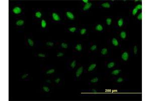 Immunofluorescence of purified MaxPab antibody to ZNF643 on HeLa cell. (ZNF643 anticorps  (AA 1-432))