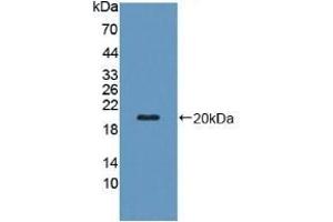 Detection of Recombinant PZP, Human using Polyclonal Antibody to Pregnancy Zone Protein (PZP) (PZP anticorps  (AA 1212-1391))