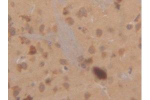 Detection of CK18 in Mouse Cerebrum Tissue using Polyclonal Antibody to Cytokeratin 18 (CK18)
