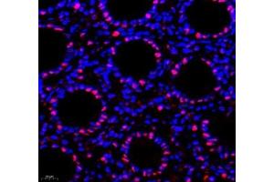 Immunofluorescence of paraffin embedded rat colon using Transketolase (ABIN7075978) at dilution of 1: 1100 (400x lens)