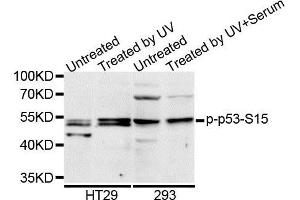 Western blot analysis of extracts of HT-29 cell line, using Phospho-p53-S15 antibody. (p53 anticorps  (pSer15))