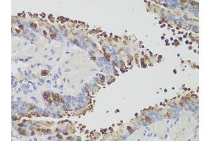 Immunohistochemistry of paraffin-embedded mouse bronchial epithelium using PDCD1 antibody (ABIN6290170) at dilution of 1:200 (40x lens).