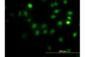 Immunofluorescence of monoclonal antibody to CSE1L on HeLa cell. (Exportin 2 anticorps  (AA 872-971))