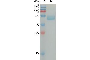 Interleukin 4 (IL4) (AA 25-153) protein (mFc Tag)