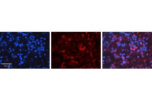 Rabbit Anti-PRKCD Antibody Catalog Number: ARP56701_P050 Formalin Fixed Paraffin Embedded Tissue: Human Lymph Node Tissue Observed Staining: Cytoplasm Primary Antibody Concentration: 1:600 Other Working Concentrations: N/A Secondary Antibody: Donkey anti-Rabbit-Cy3 Secondary Antibody Concentration: 1:200 Magnification: 20X Exposure Time: 0. (PKC delta anticorps  (N-Term))