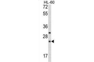 Western Blotting (WB) image for anti-Regulator of G-Protein Signaling 1 (RGS1) antibody (ABIN3003898)