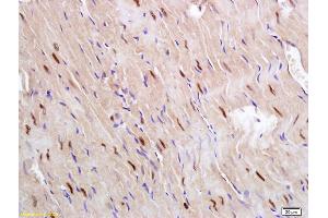 Formalin-fixed and paraffin embedded rat heart labeled with Anti Glucagon Receptor Polyclonal Antibody, Unconjugated (ABIN751528) followed by conjugation to the secondary antibody and DAB staining (Glucagon Receptor anticorps  (AA 11-110))
