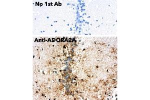 Immunohistochemistry (IHC) image for anti-Adenosine A2a Receptor (ADORA2A) (C-Term) antibody (ABIN7272985)