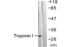 Western Blotting (WB) image for anti-Cardiac Troponin I (TNNI3) (AA 11-60) antibody (ABIN2888778) (TNNI3 anticorps  (AA 11-60))