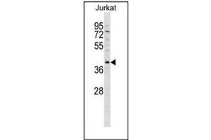 Western blot analysis of DNMT3L Antibody (C-term) in Jurkat cell line lysates (35ug/lane). (DNMT3L anticorps  (C-Term))