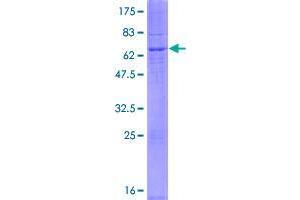 Image no. 1 for Degenerative Spermatocyte Homolog 2, Lipid Desaturase (DEGS2) (AA 1-323) protein (GST tag) (ABIN1351436)
