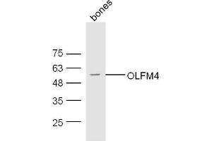 Olfactomedin 4 anticorps  (AA 111-510)
