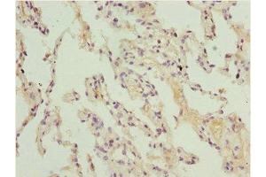 Immunohistochemistry of paraffin-embedded human lung tissue using ABIN7150982 at dilution of 1:100 (ARIH2 anticorps  (AA 194-493))