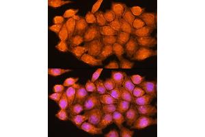 Immunofluorescence analysis of HeLa cells using ADK Rabbit pAb  at dilution of 1:100.