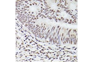 Immunohistochemistry of paraffin-embedded human tonsil using /IB Rabbit pAb (2391) at dilution of 1:50 (40x lens).