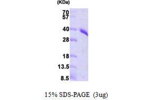 SDS-PAGE (SDS) image for phosphoribosyl Pyrophosphate Synthetase 1 (PRPS1) (AA 1-318) protein (His tag) (ABIN666934) (PRPS1 Protein (AA 1-318) (His tag))