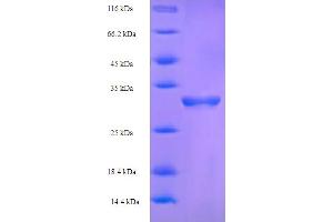 SDS-PAGE (SDS) image for Coagulation Factor V (F5) (AA 1490-1614), (partial) protein (His-SUMO Tag) (ABIN5709491) (Coagulation Factor V Protein (F5) (AA 1490-1614, partial) (His-SUMO Tag))