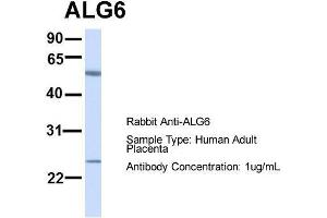 Host:  Rabbit  Target Name:  ALG6  Sample Type:  Human Adult Placenta  Antibody Dilution:  1. (ALG6 anticorps  (N-Term))