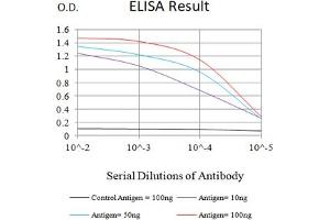 Black line: Control Antigen (100 ng),Purple line: Antigen (10 ng), Blue line: Antigen (50 ng), Red line:Antigen (100 ng)