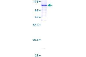 Image no. 1 for Dynein, Axonemal, Intermediate Chain 1 (DNAI1) (AA 1-699) protein (GST tag) (ABIN1351746) (DNAI1 Protein (AA 1-699) (GST tag))