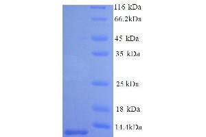 Pulmonary Surfactant-Associated Protein B (AA 188-266) protein (His tag)