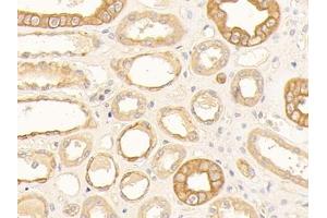 Detection of CK10 in Human Kidney Tissue using Polyclonal Antibody to Cytokeratin 10 (CK10)