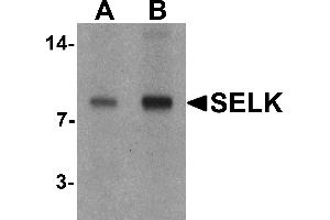 Western blot analysis of SELK in A20 cell lysate with SELK antibody at (A) 1 and (B) 2 µg/mL. (Selenoprotein K anticorps  (C-Term))