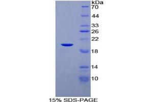 SDS-PAGE analysis of Human C/EBP gamma Protein. (CEBPG Protéine)