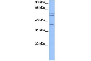 CCDC78 antibody used at 1 ug/ml to detect target protein.