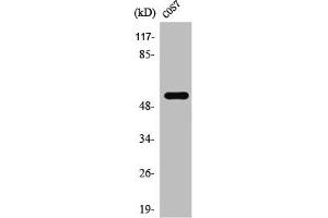 Western Blot analysis of COLO205 cells using TADA2L Polyclonal Antibody (TADA2L anticorps  (Internal Region))