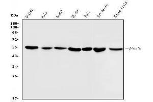 Western blot analysis of Beta Tubulin using anti-Beta Tubulin antibody (ABIN7602743).