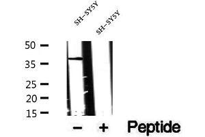 Western blot analysis of extracts of SH-SY5Y cells, using CXXC5 antibody. (CXXC5 anticorps)