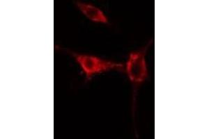 ABIN6275467 staining  HuvEc cells by IF/ICC. (RAB37 anticorps  (C-Term))