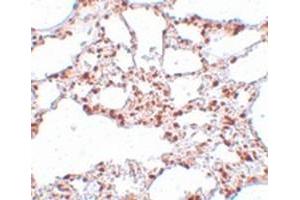 Immunohistochemical staining of rat lung tissue with ZSCAN4 polyclonal antibody  at 5 ug/mL dilution. (ZSCAN4 anticorps  (C-Term))