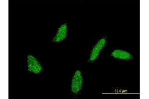 Immunofluorescence of monoclonal antibody to UBE2U on HeLa cell. (UBE2U anticorps  (AA 9-102))
