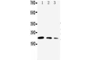 Anti-CDC42 antibody, Western blotting Lane 1: Recombinant Human CDC42 Protein 10ng Lane 2: Recombinant Human CDC42 Protein 5ng Lane 3: Recombinant Human CDC42 Protein 2. (CDC42 anticorps  (Middle Region))