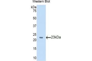 Western blot analysis of the recombinant protein. (SLIT2 anticorps  (AA 31-197))
