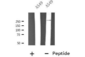 Western blot analysis of extracts from A549 cells, using CACNA1H antibody.