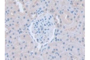 Detection of ITSN1 in Rat Kidney Tissue using Polyclonal Antibody to Intersectin 1 (ITSN1) (ITSN1 anticorps  (AA 1-227))